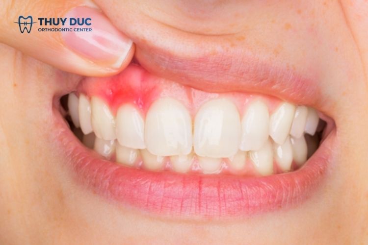 Trồng răng giả có làm ảnh hưởng tới sức khỏe hay không? 1