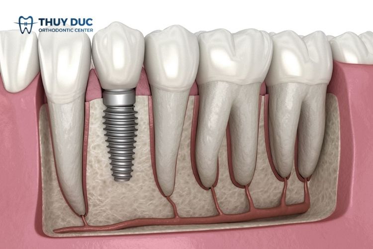 Các dây thần kinh bị ảnh hưởng 1