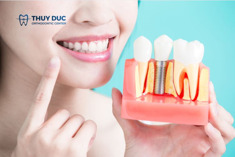 Bền chắc, tạo độ ăn nhai chân thật 1