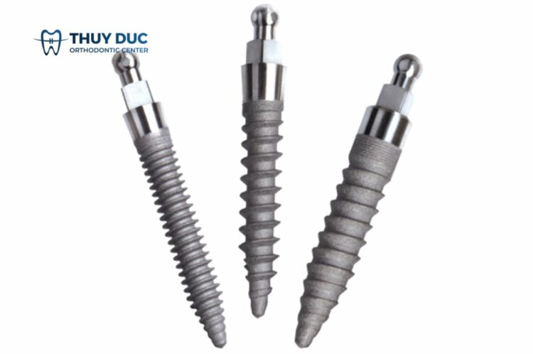 Cấy ghép mini implant có đắt không? 1