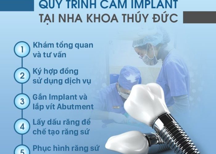 Quy trình trồng răng implant chuẩn Y khoa