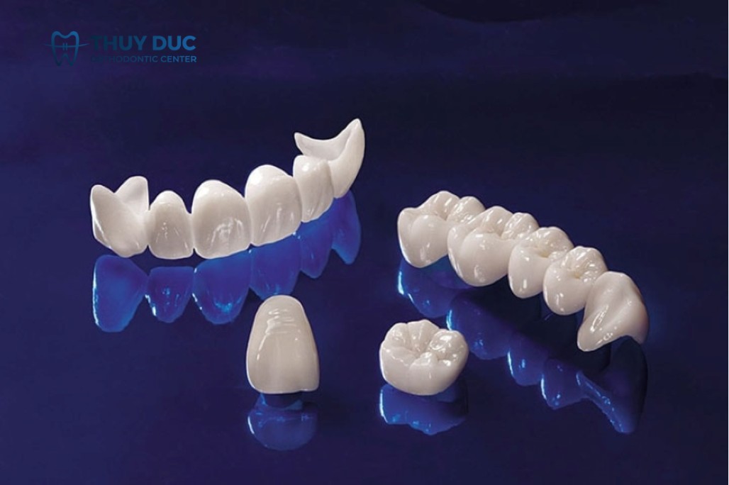 Răng sứ implant cao cấp 1