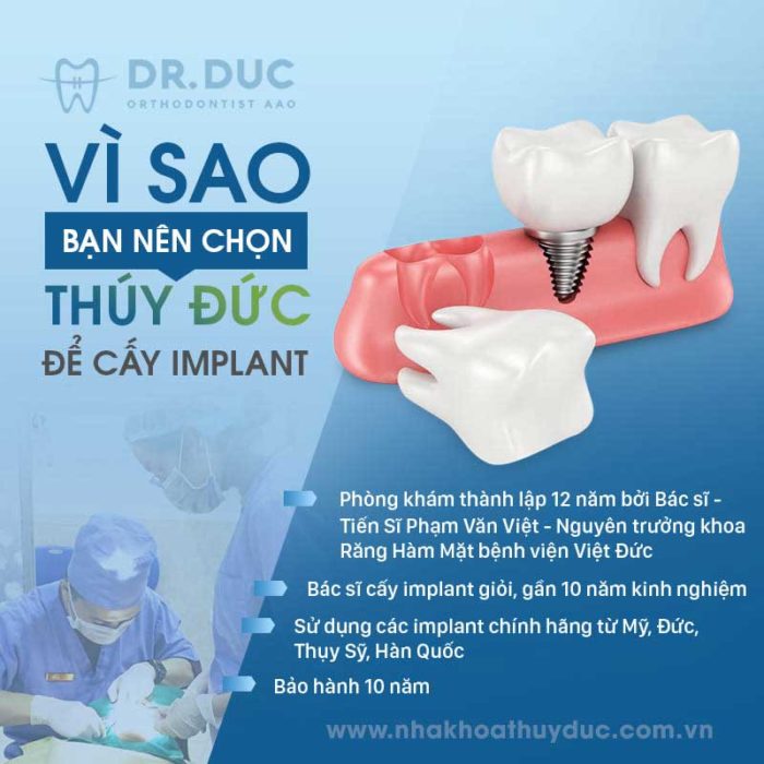 Trồng răng implant tại đâu tốt nhất Hà Nội? 1