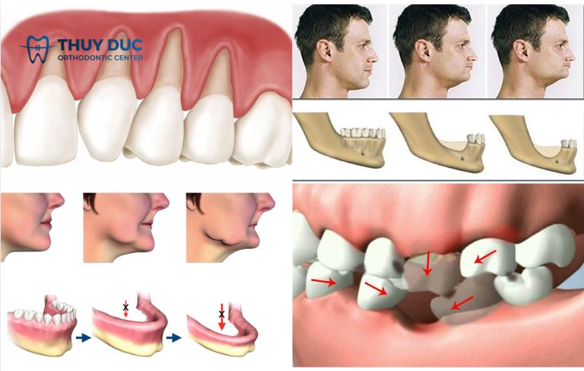 Ảnh hưởng đến công việc và cuộc sống 1