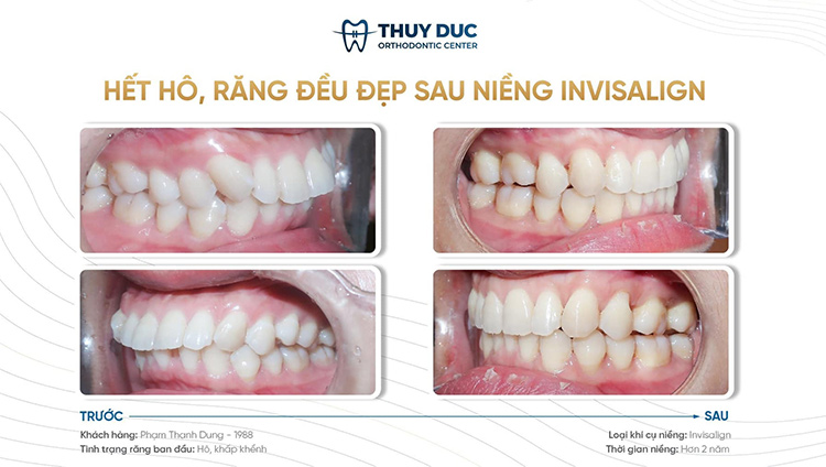 2.5. Hiệu quả cao 2