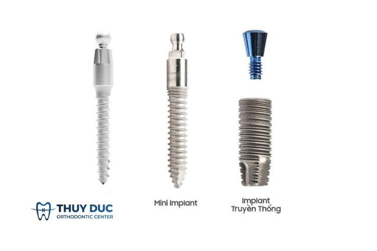 Thế nào là trồng răng mini implant? 1