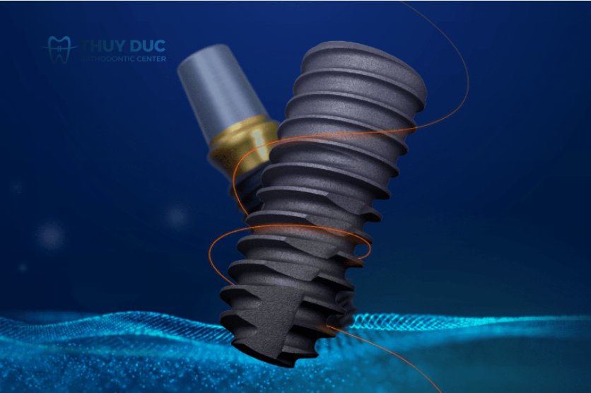 Trụ implant Osstem Hàn Quốc 1