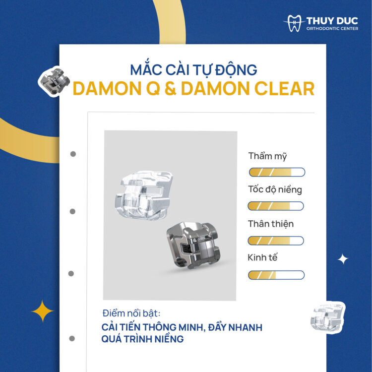 Niềng răng hô mắc cài sứ tự động 1