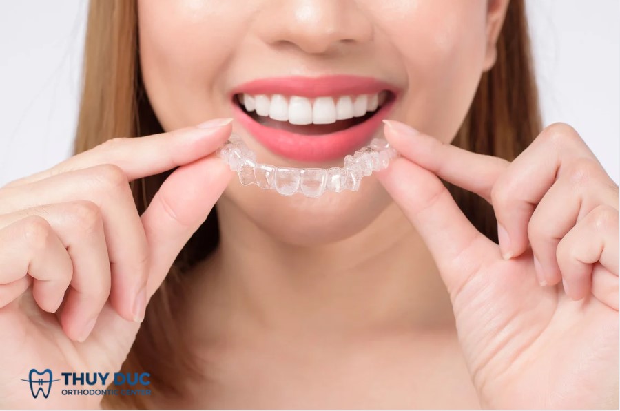 Hiểu như thế nào về niềng răng không mắc cài? 1