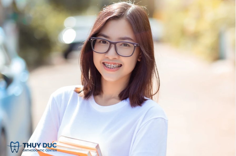 Phương pháp niềng răng cho người bị lệch nhân trung 1