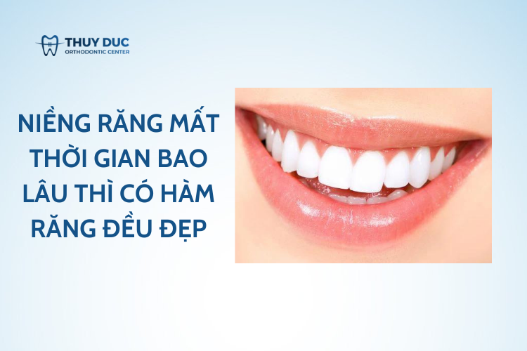 Niềng răng mất thời gian bao lâu thì có hàm răng đều đẹp