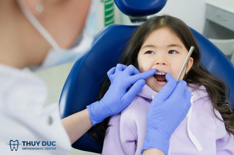 Những trường hợp nên cân nhắc niềng răng cho trẻ 1
