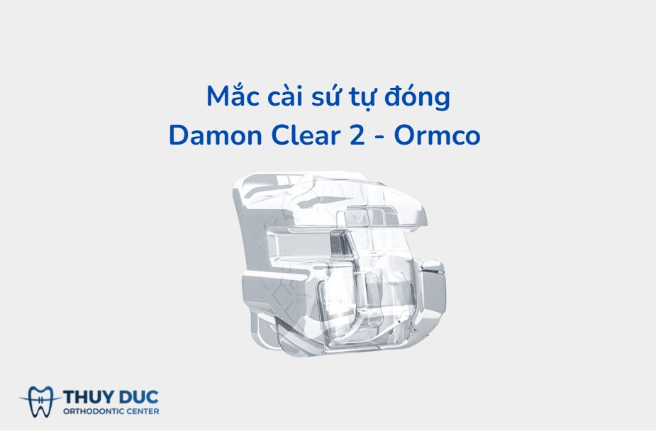 4. Damon Clear 2 - Đỉnh cao thẩm mỹ và công nghệ 1