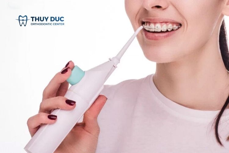 Niềng răng dùng bàn chải gì? - Nha khoa Thúy Đức tư vấn 1