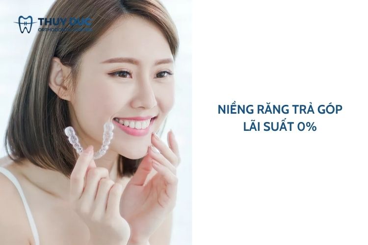 Niềng răng trả góp là gì? 1