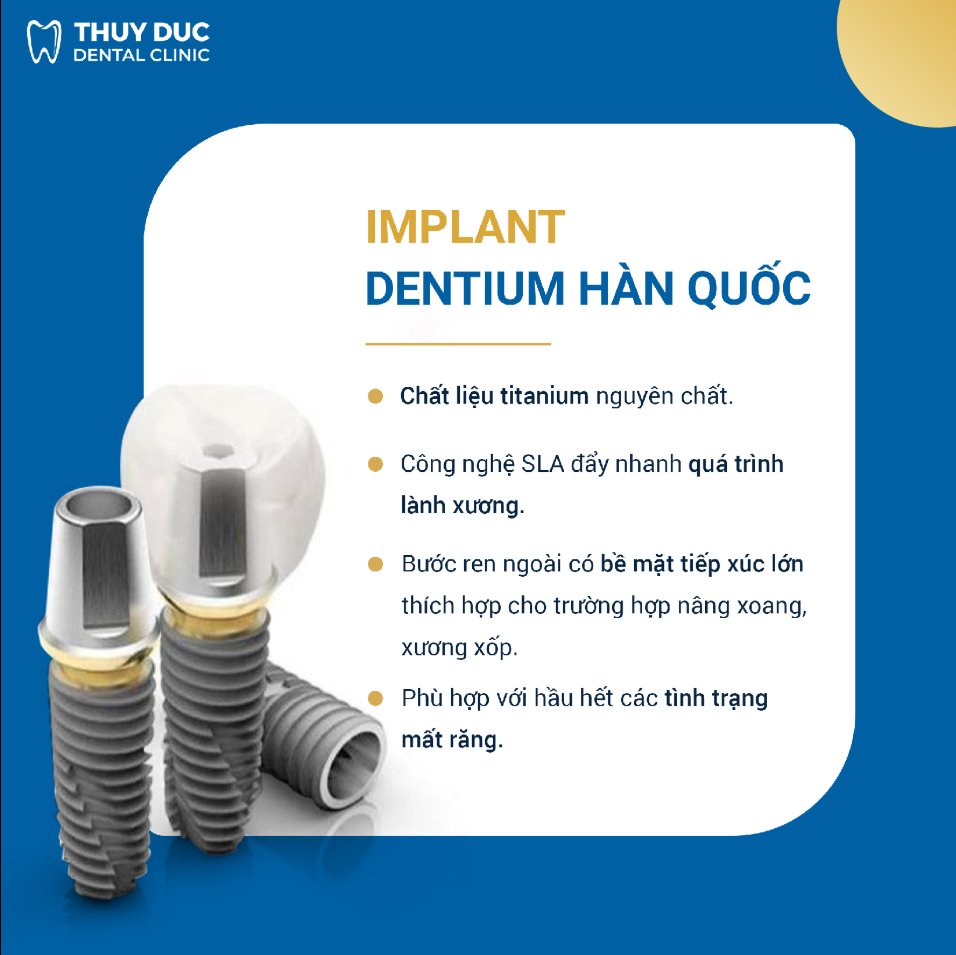 Ưu điểm của trụ implant Dentium Hàn Quốc 1