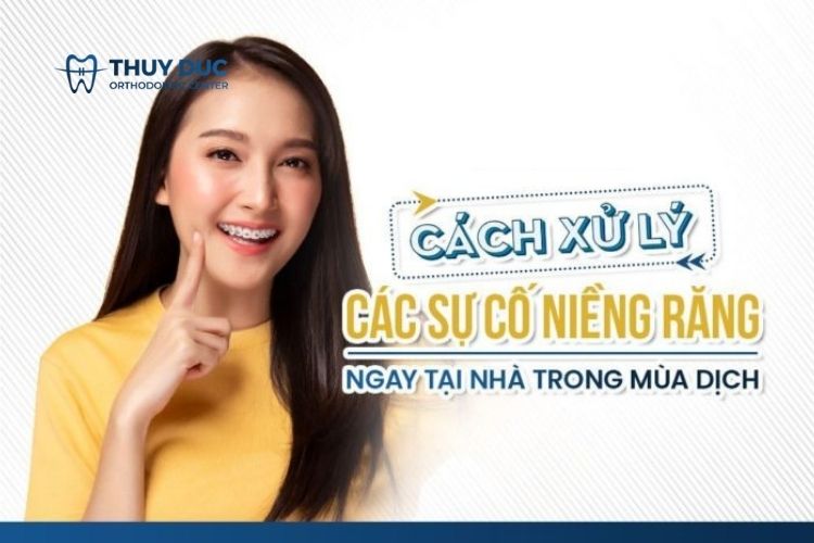 Cách xử lý các sự cố niềng răng mắc cài tại nhà mùa Covid 1