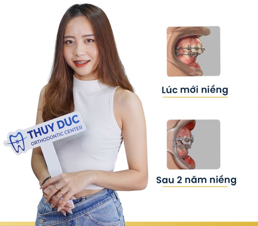 2.4. Chính sách trả góp linh hoạt - Hỗ trợ tài chính tại Thúy Đức 1