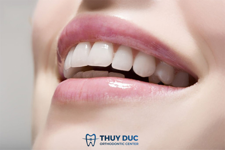Ưu điểm của phương pháp bọc răng sứ 1
