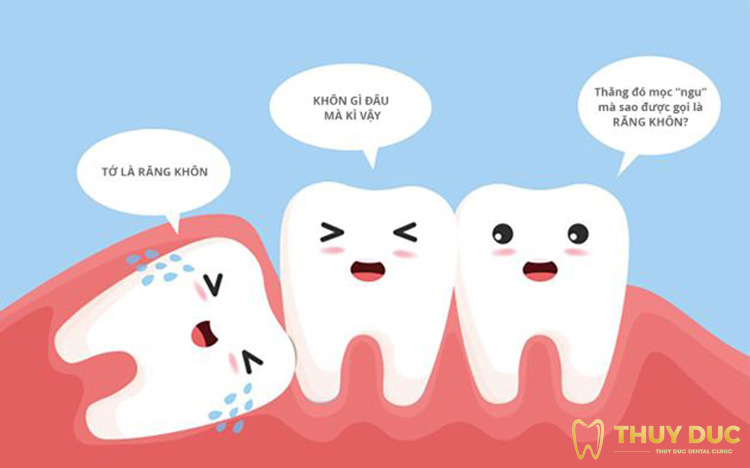 Những đặc điểm khác biệt của răng khôn 1