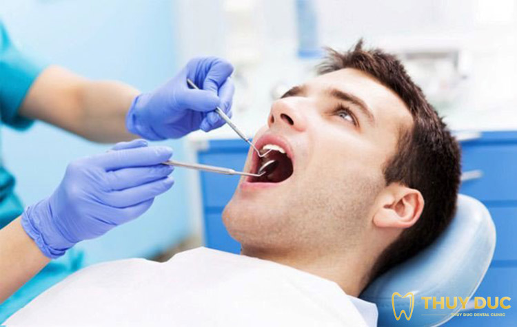Một số câu hỏi liên quan đến cắt lợi trùm răng khôn 1