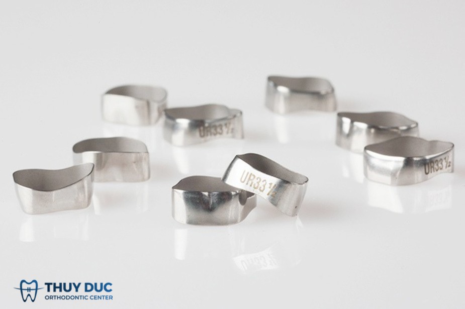 Giải đáp cụ thể band niềng răng là gì? 1