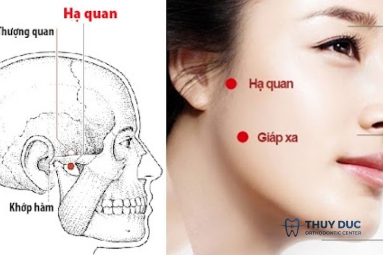 Bấm huyệt hạ quan 1