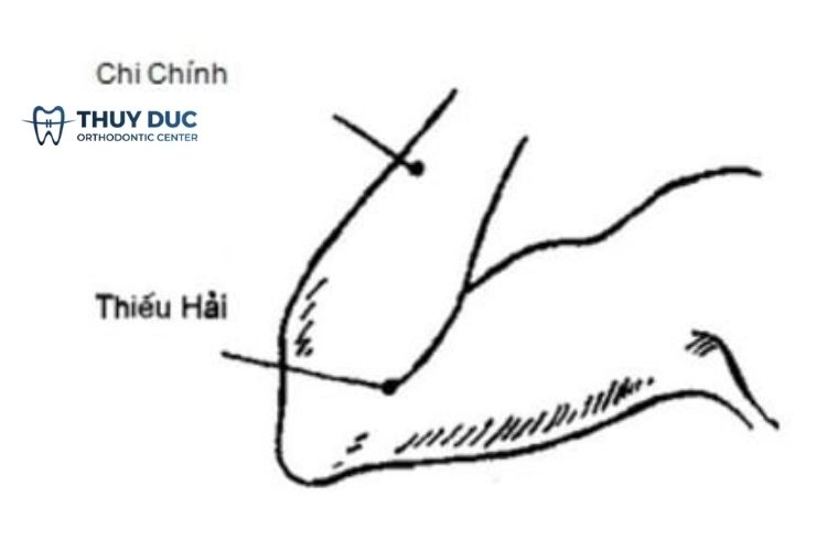 Bấm huyệt thiếu hải 1