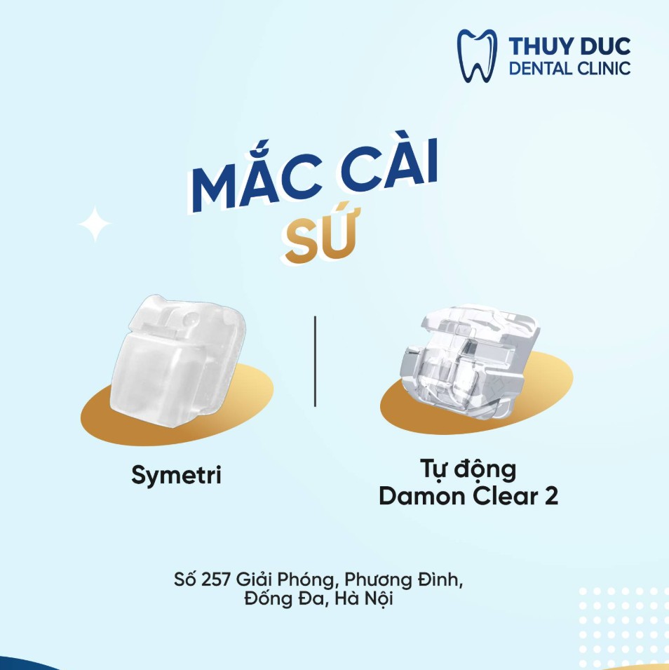 Niềng răng mắc cài sứ ORMCO 1