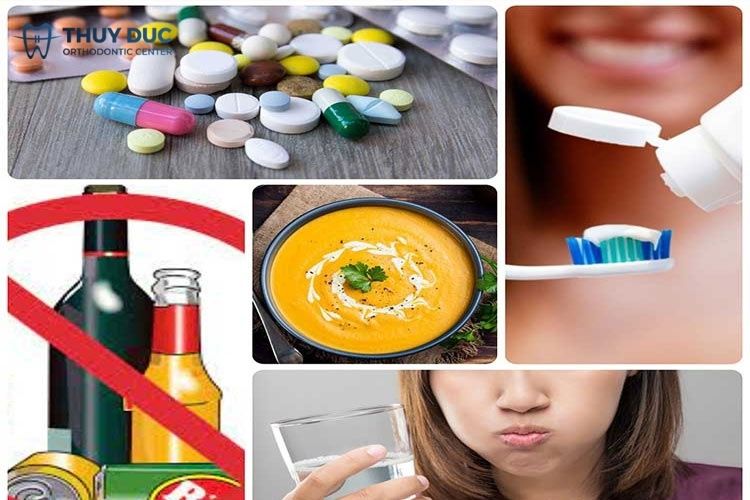 Hướng dẫn cách chăm sóc trước và sau khi nhổ răng số 7 2 Hướng dẫn cách chăm sóc trước và sau khi nhổ răng số 7 2