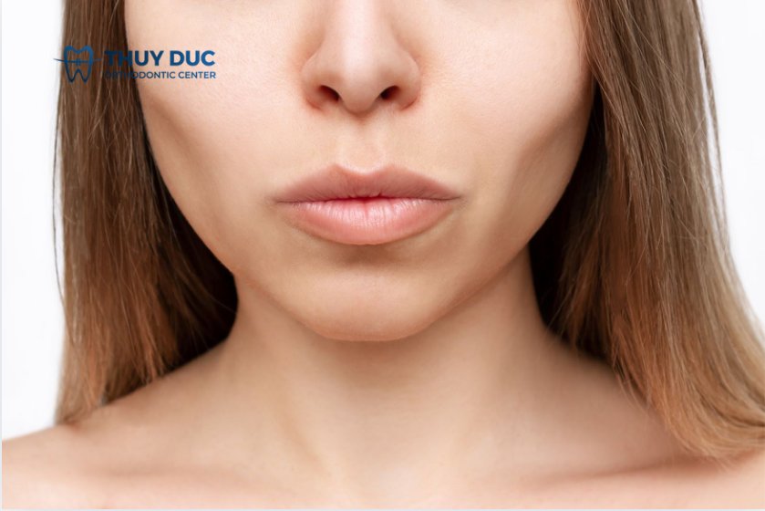 Nhổ răng số 6 có bị hóp má không? 1
