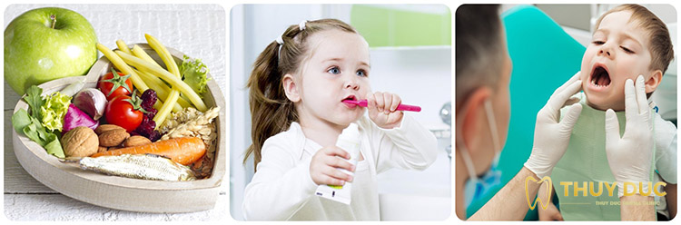 Cách phòng ngừa sâu răng ở trẻ em 1