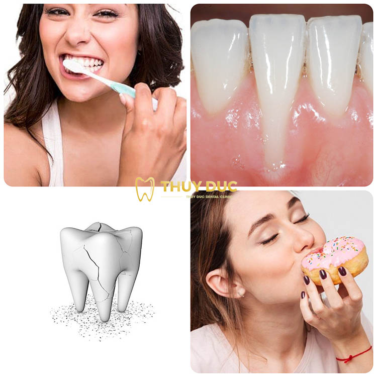 Những nguyên nhân gây sâu răng 1