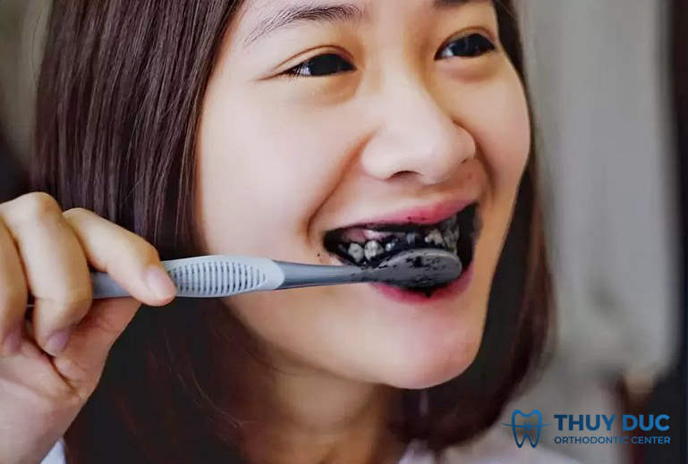 Đánh răng trực tiếp với than hoạt tính 1