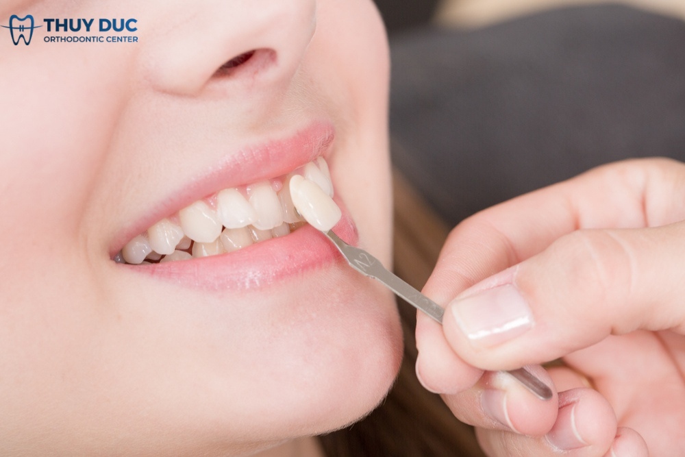 Thế nào là một quy trình bọc răng sứ chuẩn y khoa? 1