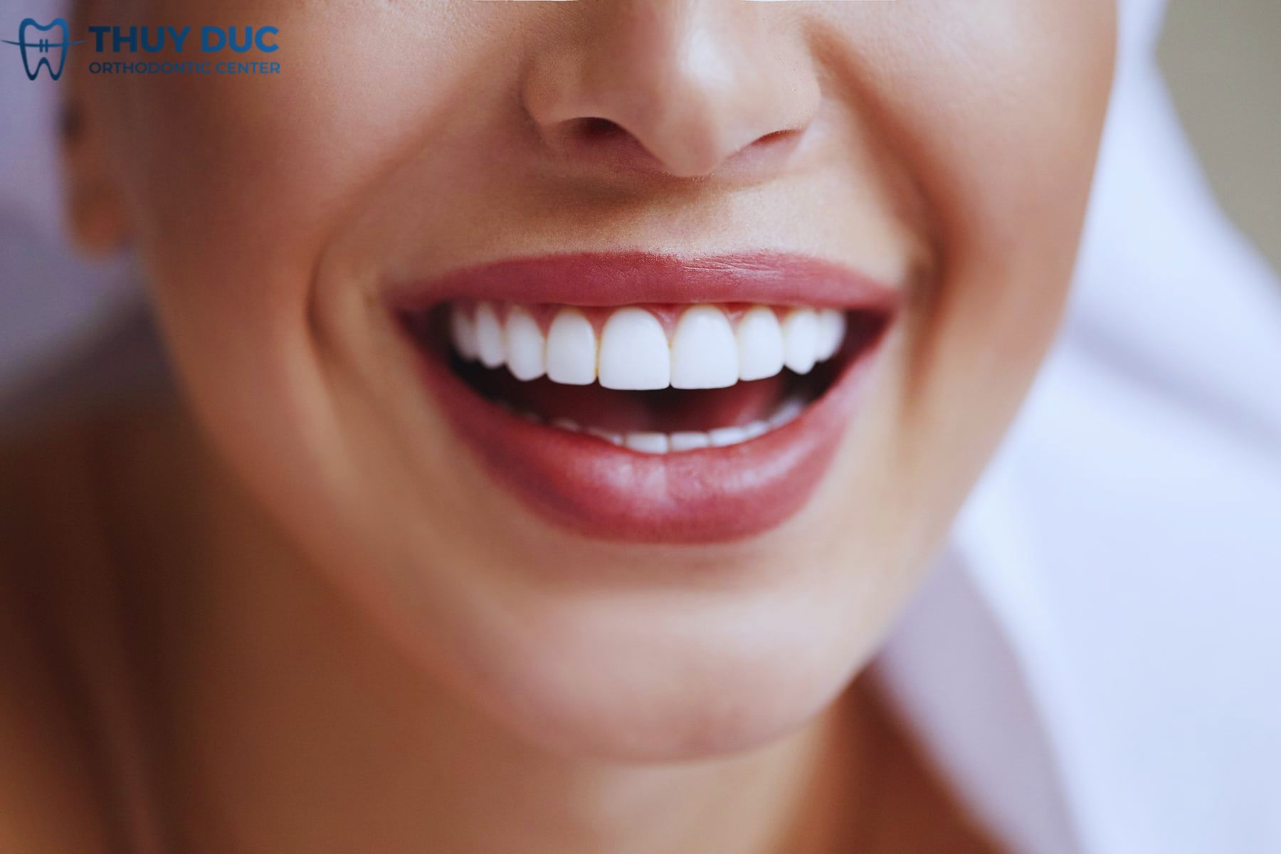 Răng sứ kim loại là gì? 1