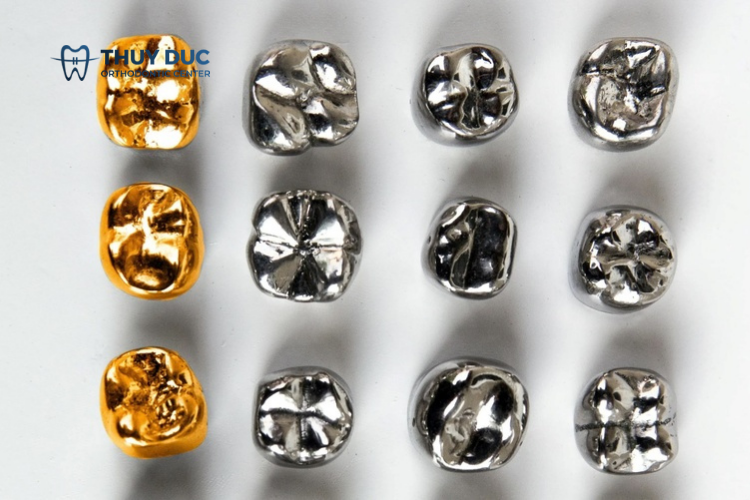 Răng sứ kim loại quý 1