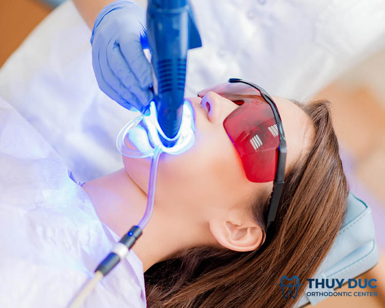 Tẩy trắng răng bằng công nghệ cao tại nha khoa 1