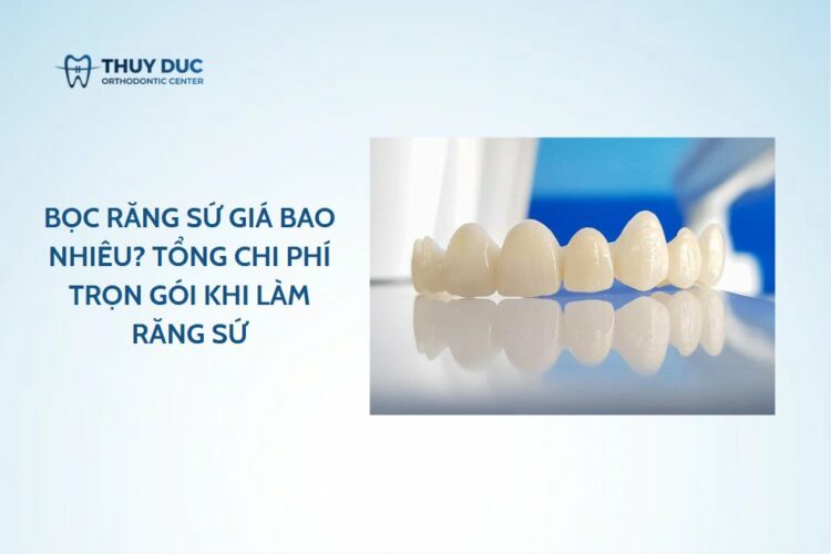 Bọc răng sứ giá bao nhiêu? Tổng chi phí trọn gói khi làm răng sứ