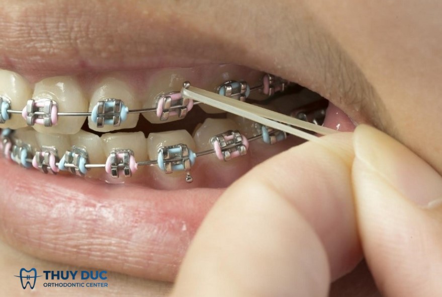 4. Hướng dẫn sử dụng thun liên hàm đúng cách 2