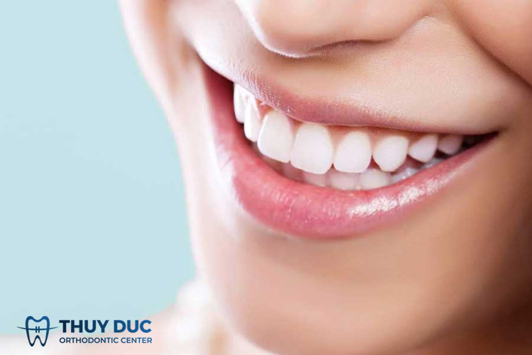 Những lợi ích khi bọc răng sứ cho 4 răng cửa bị hô 1