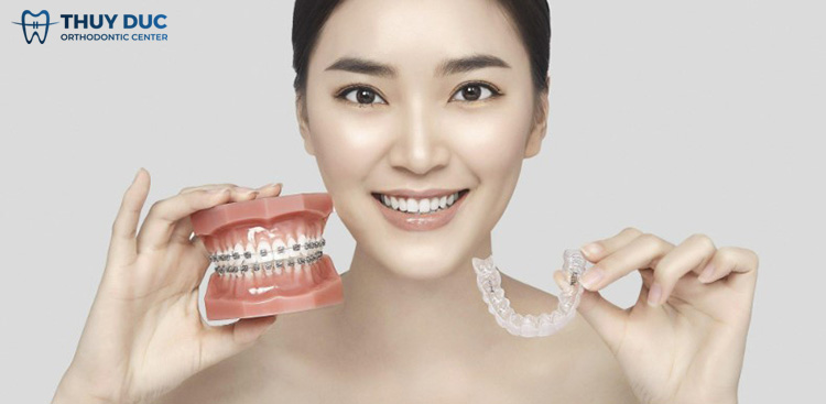 Phương pháp niềng răng phù hợp nhất sau khi làm răng sứ 1