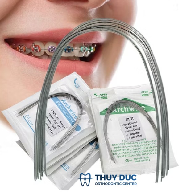 2. Dây Niken – Titan (NiTi) 1 2. Dây Niken – Titan (NiTi) 1