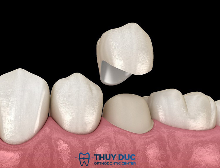 Câu hỏi thường gặp về răng sữa và răng vĩnh viễn? 2