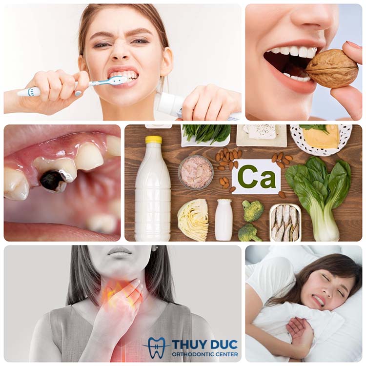 3. Nguyên nhân gây tình trạng răng bị sứt mẻ 1