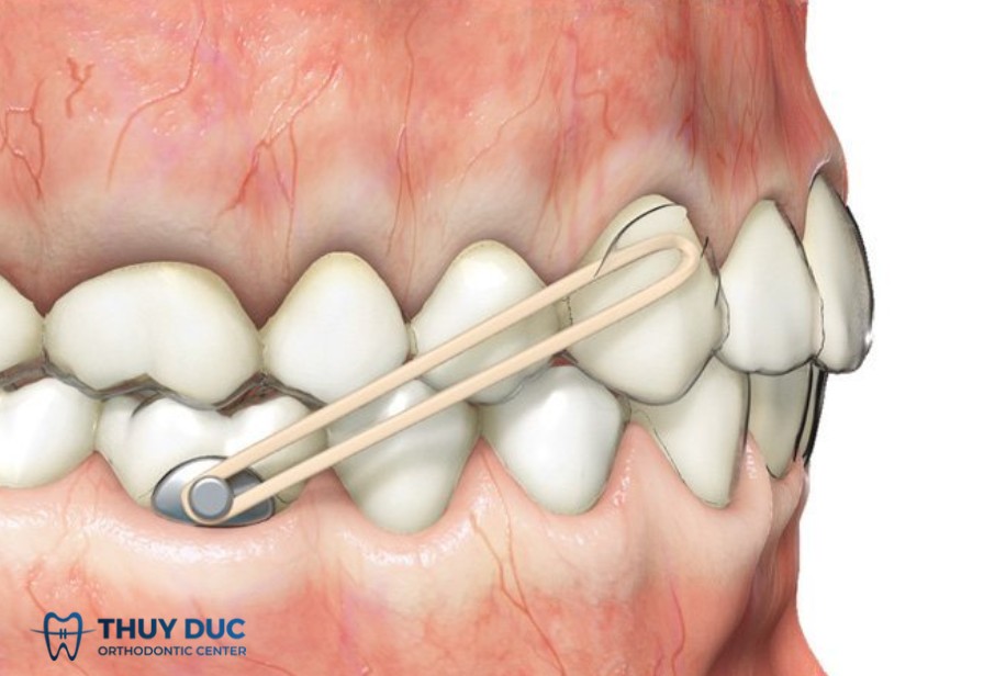 16/ Precision cuts / Buttons 1 16/ Precision cuts / Buttons 1