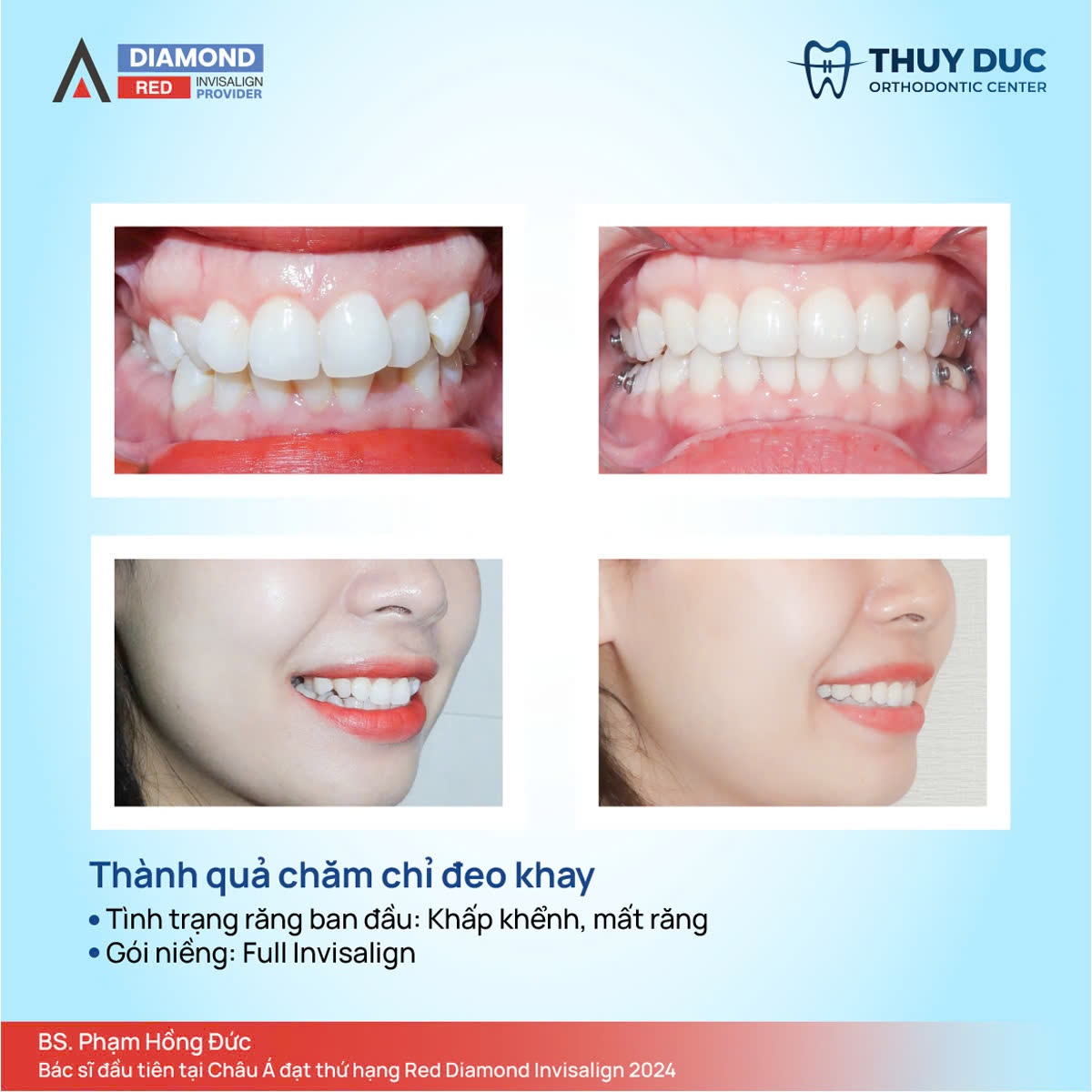 Ảnh hưởng thẩm mỹ 1