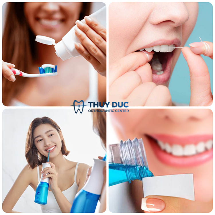 Chăm sóc răng miệng cẩn thận 1