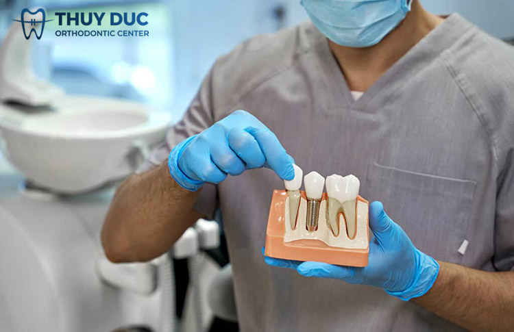 4. Chi phí trồng răng implant cho người cho người cao tuổi 1