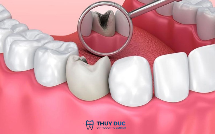 Kiểm tra bệnh lý răng miệng để kịp thời chữa trị 1